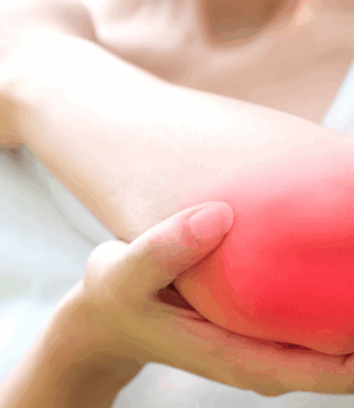 tennis elbow | Body First Wellness Center tennis elbow